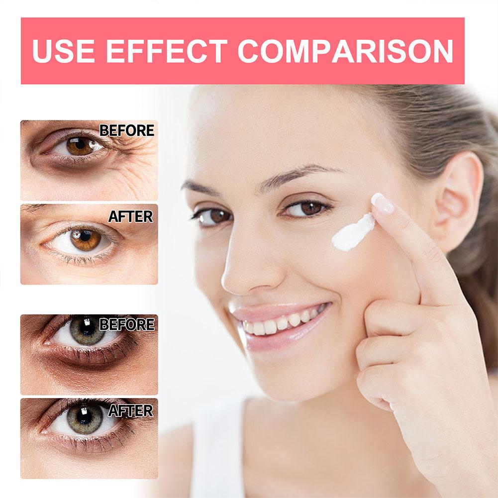 Retinol Eye Cream Lightening D - The Ordinary Serum Hyaluronic Acid review and price